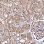 NNT1 Antibody in Immunohistochemistry (Paraffin) (IHC (P))