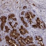 SEMG1 Antibody in Immunohistochemistry (IHC)