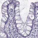 SEMG1 Antibody in Immunohistochemistry (IHC)