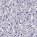 SEMG1 Antibody in Immunohistochemistry (IHC)