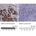 SEMG1 Antibody