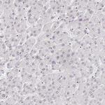 AKAP8L Antibody in Immunohistochemistry (IHC)