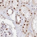 AKAP8L Antibody in Immunohistochemistry (IHC)