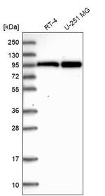 AKAP8L Antibody in Western Blot (WB)