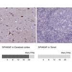 SPHKAP Antibody in Immunohistochemistry (IHC)