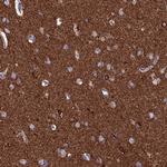 CEND Antibody in Immunohistochemistry (IHC)