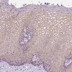 Periplakin Antibody in Immunohistochemistry (Paraffin) (IHC (P))