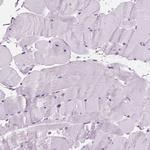 Periplakin Antibody in Immunohistochemistry (Paraffin) (IHC (P))