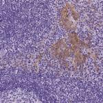 Periplakin Antibody in Immunohistochemistry (Paraffin) (IHC (P))