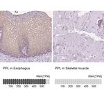 Periplakin Antibody in Immunohistochemistry (IHC)