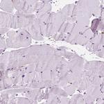 Periplakin Antibody in Immunohistochemistry (IHC)