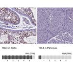 TBL3 Antibody in Immunohistochemistry (IHC)