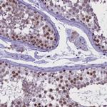 TBL3 Antibody in Immunohistochemistry (IHC)