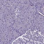 TBL3 Antibody in Immunohistochemistry (IHC)