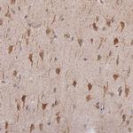 TAPT1 Antibody in Immunohistochemistry (Paraffin) (IHC (P))