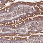 TAPT1 Antibody in Immunohistochemistry (Paraffin) (IHC (P))