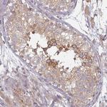 TAPT1 Antibody in Immunohistochemistry (Paraffin) (IHC (P))