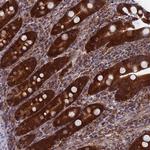 DTYMK Antibody in Immunohistochemistry (Paraffin) (IHC (P))