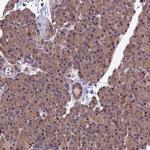 PIKFYVE Antibody in Immunohistochemistry (Paraffin) (IHC (P))