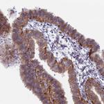 B9D2 Antibody in Immunohistochemistry (Paraffin) (IHC (P))