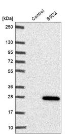 B9D2 Antibody in Western Blot (WB)