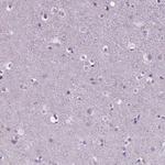 BANF2 Antibody in Immunohistochemistry (Paraffin) (IHC (P))