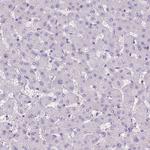 BANF2 Antibody in Immunohistochemistry (Paraffin) (IHC (P))