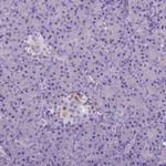 BANF2 Antibody in Immunohistochemistry (Paraffin) (IHC (P))