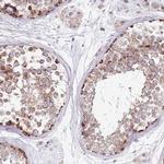 RARS2 Antibody in Immunohistochemistry (Paraffin) (IHC (P))