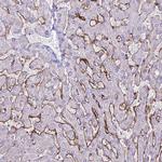 CD299 (DC-SIGN/L) Antibody in Immunohistochemistry (IHC)