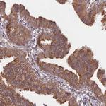 TMEM259 Antibody in Immunohistochemistry (Paraffin) (IHC (P))