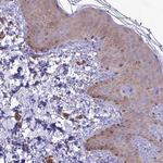 TMEM259 Antibody in Immunohistochemistry (Paraffin) (IHC (P))