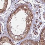 TMEM259 Antibody in Immunohistochemistry (IHC)