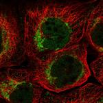 QIL1 Antibody in Immunocytochemistry (ICC/IF)