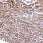 QIL1 Antibody in Immunohistochemistry (Paraffin) (IHC (P))