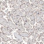 QIL1 Antibody in Immunohistochemistry (Paraffin) (IHC (P))