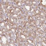 QIL1 Antibody in Immunohistochemistry (Paraffin) (IHC (P))