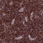 ARHGEF18 Antibody in Immunohistochemistry (IHC)