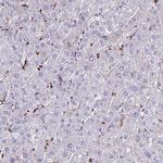 ARHGEF18 Antibody in Immunohistochemistry (IHC)