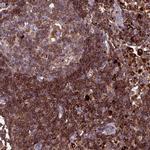 ARHGEF18 Antibody in Immunohistochemistry (IHC)