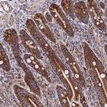 DTYMK Antibody in Immunohistochemistry (Paraffin) (IHC (P))