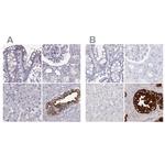 SEMG2 Antibody in Immunohistochemistry (IHC)