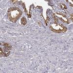 SEMG2 Antibody in Immunohistochemistry (IHC)