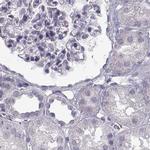 SEMG2 Antibody in Immunohistochemistry (IHC)