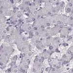 SEMG2 Antibody in Immunohistochemistry (IHC)