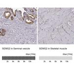 SEMG2 Antibody