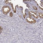 SEMG2 Antibody in Immunohistochemistry (IHC)