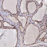 ANKRD27 Antibody in Immunohistochemistry (IHC)