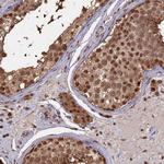 PSMC6 Antibody in Immunohistochemistry (Paraffin) (IHC (P))