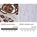 SEMG2 Antibody in Immunohistochemistry (IHC)